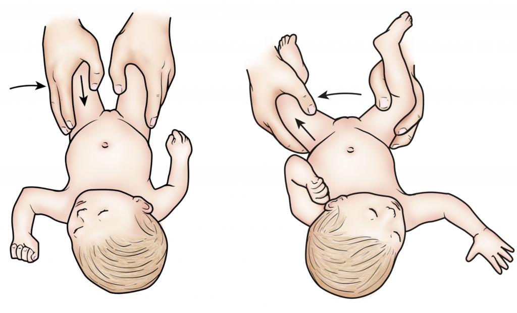 Масаж для розвитку кульшових суглобів у немовлят + відео