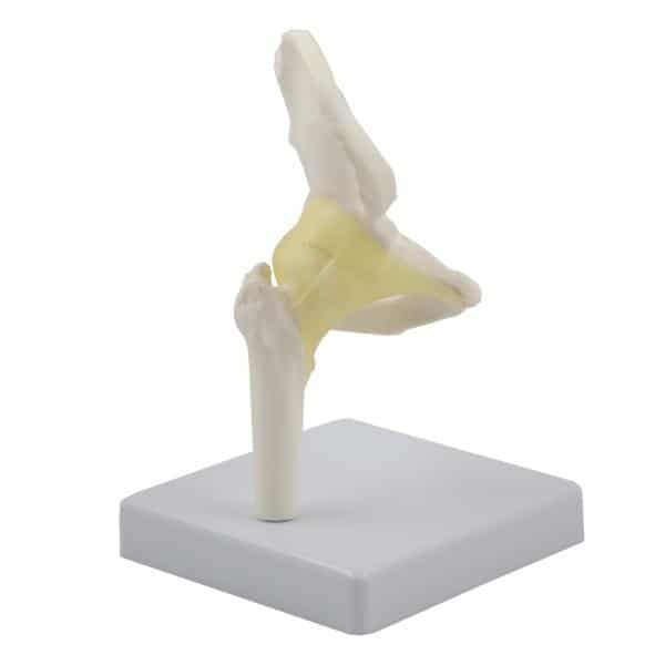 anatomichna model kulshovoho suhloba